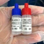 ASO LATEX 100 DET (AGLUTINACION) ANTIESTREPTOLISINA O