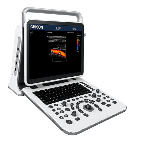 ECOGRAFO DOPPLER COLOR DIGITAL PORTATIL 2 SONDAS - Imagen 1