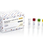 HIV RT-PCR FLUORESCENCE QUANTITATIVE DETECTION KIT 32T