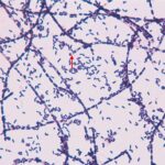 LAMINA PREPARADA BACILLUS ANTHRACIS GRAM (+).