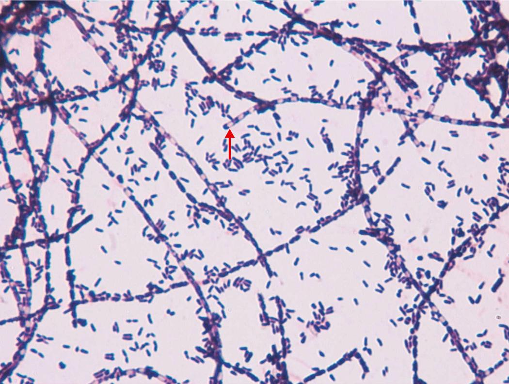 LAMINA_PREPARADA_BACILLUS_ANTHRACIS_GRAM_._AVANTOR.jpg LAMINA PREPARADA BACILLUS ANTHRACIS GRAM (+). - Imagen 1