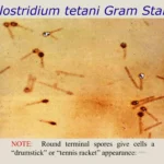 LAMINA PREPARADA CLOSTRIDIUM TETANI GRAM (+).