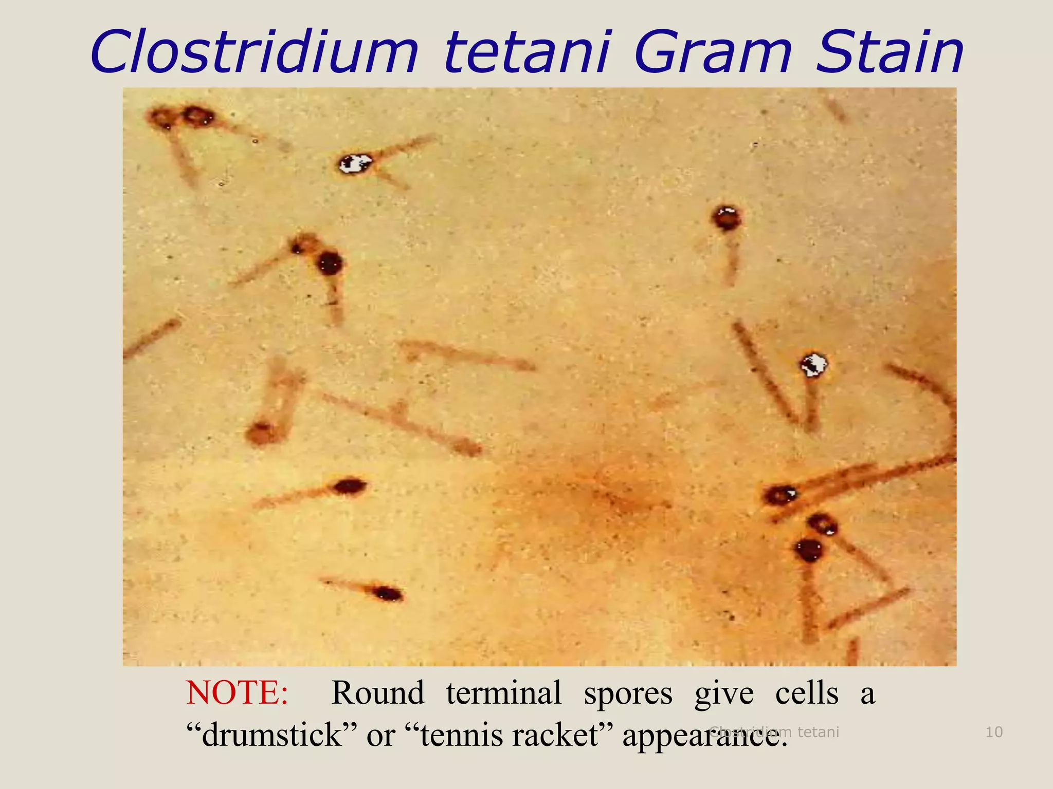 LAMINA_PREPARADA_CLOSTRIDIUM_TETANI_GRAM_._AVANTOR.webp LAMINA PREPARADA CLOSTRIDIUM TETANI GRAM (+). - Imagen 1